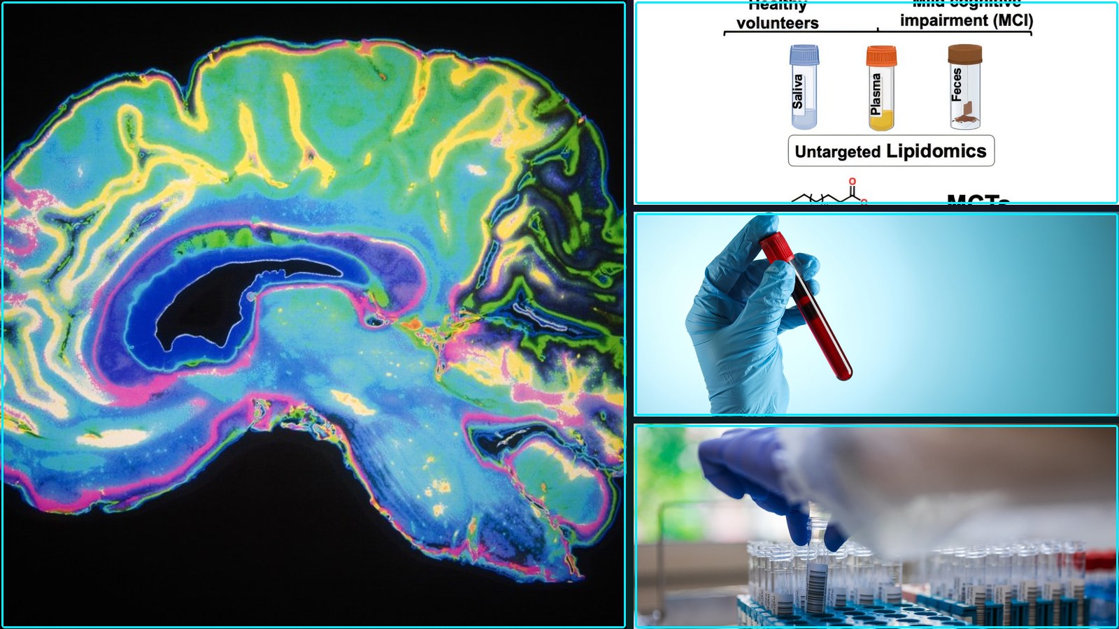 Composite featured image for New Blood Tests and Biomarkers for Early Detection - 2026-W18