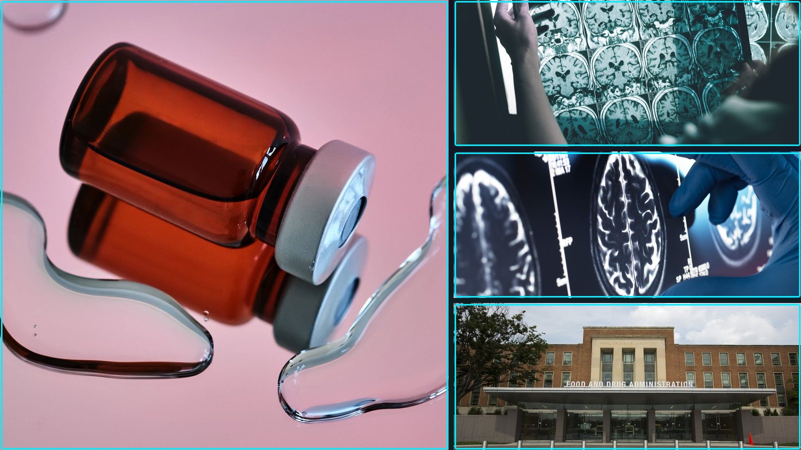 Roundup: Evaluating Alzheimer’s Drugs &, Alzheimers Drugs Provide No, and more.