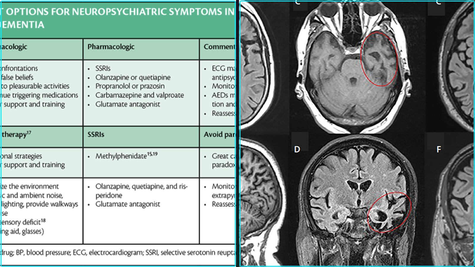 Composite featured image for Frontotemporal Signals - 2026-W19-NEWS