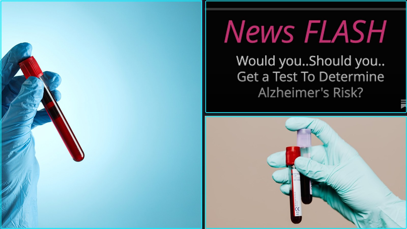 Roundup: Blood Signals, Blood test has potential detect earliest signals Alzheimer’s, and more.