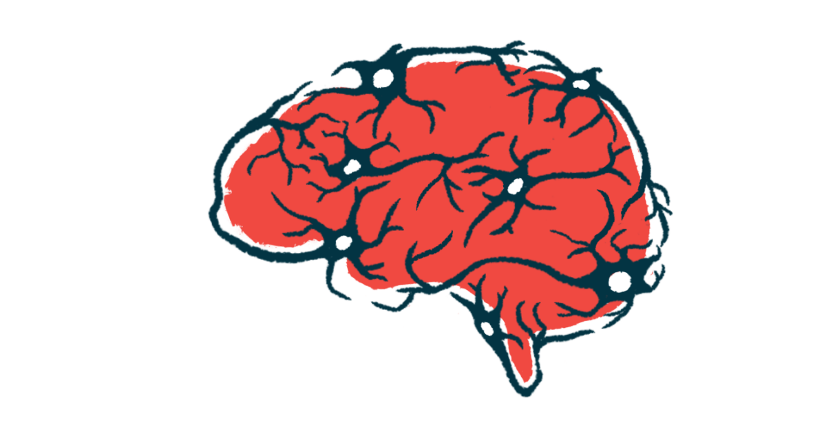 Daily Alzheimer’s pill slows brain shrinkage, boosts cognition