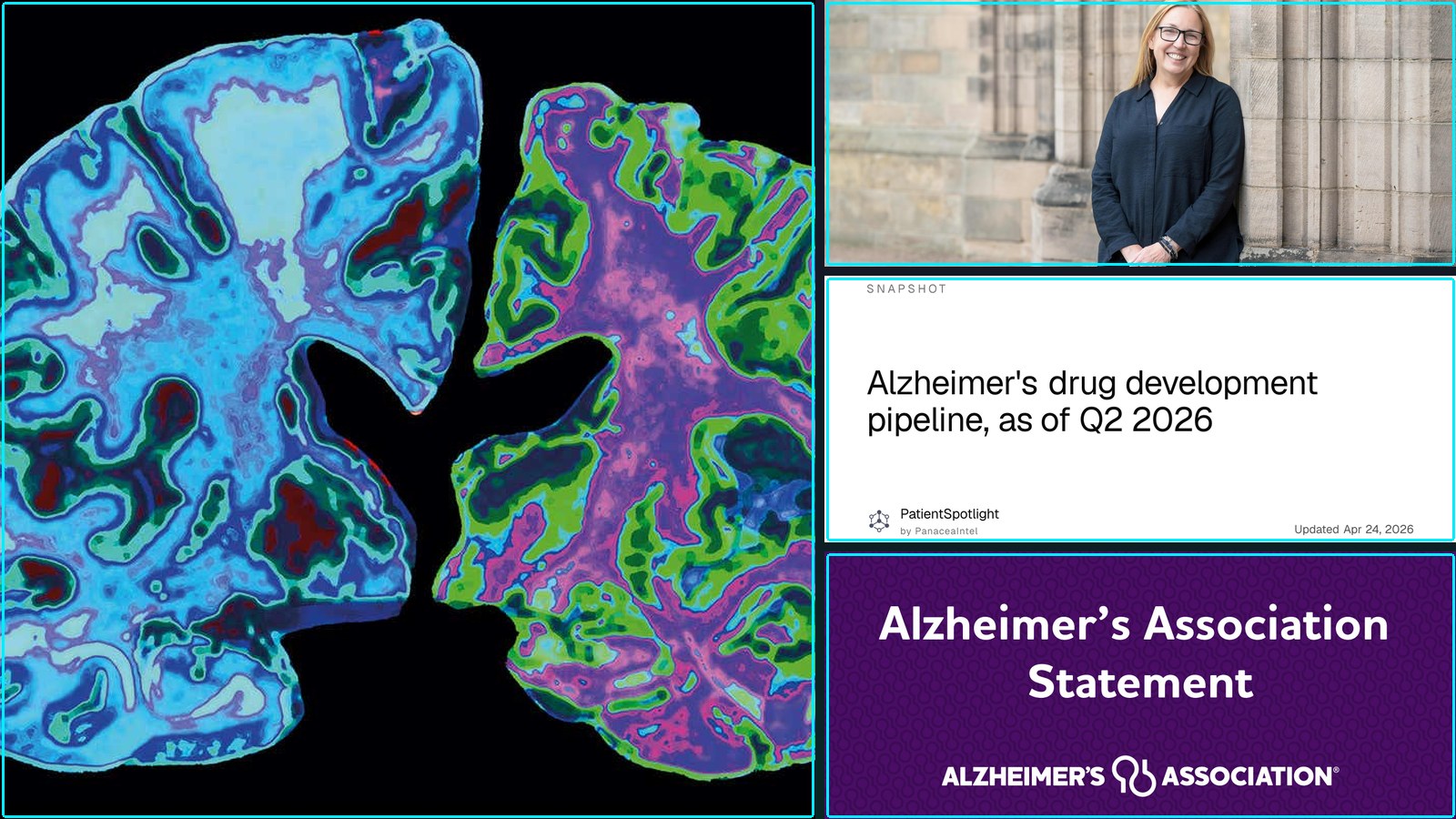 Composite featured image for New Alzheimer's Drug Trials and Clinical Results - 2026-W16