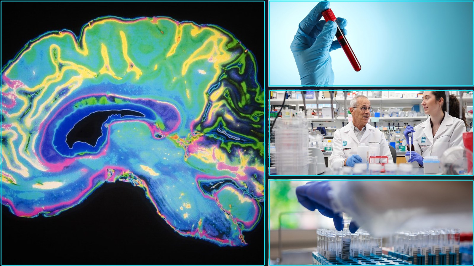 Composite featured image for Blood Tests and Diagnostic Advances - 2026-W16
