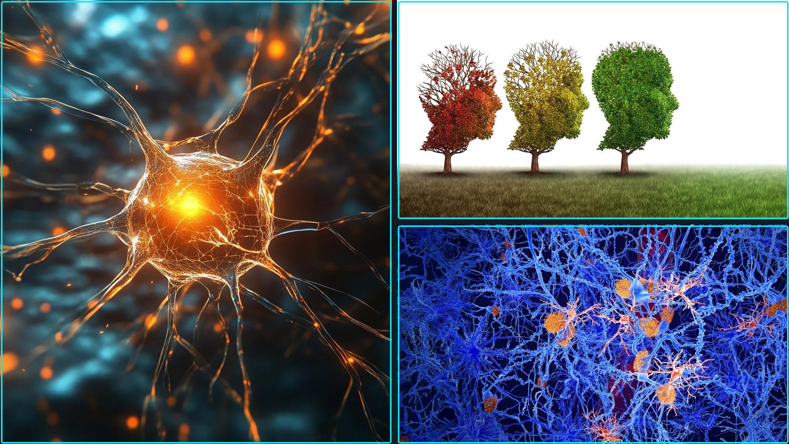 Composite featured image for Alzheimer's Disease and Frontal Temporal Dementia — 2026-W25