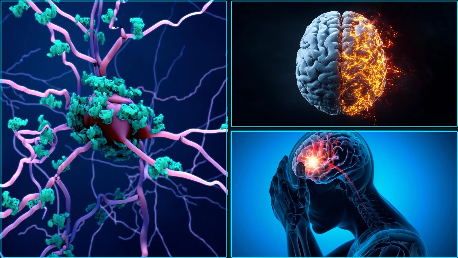 New Scientific Findings on, Scientists may have finally found how Alzheimer’s kills, and more.