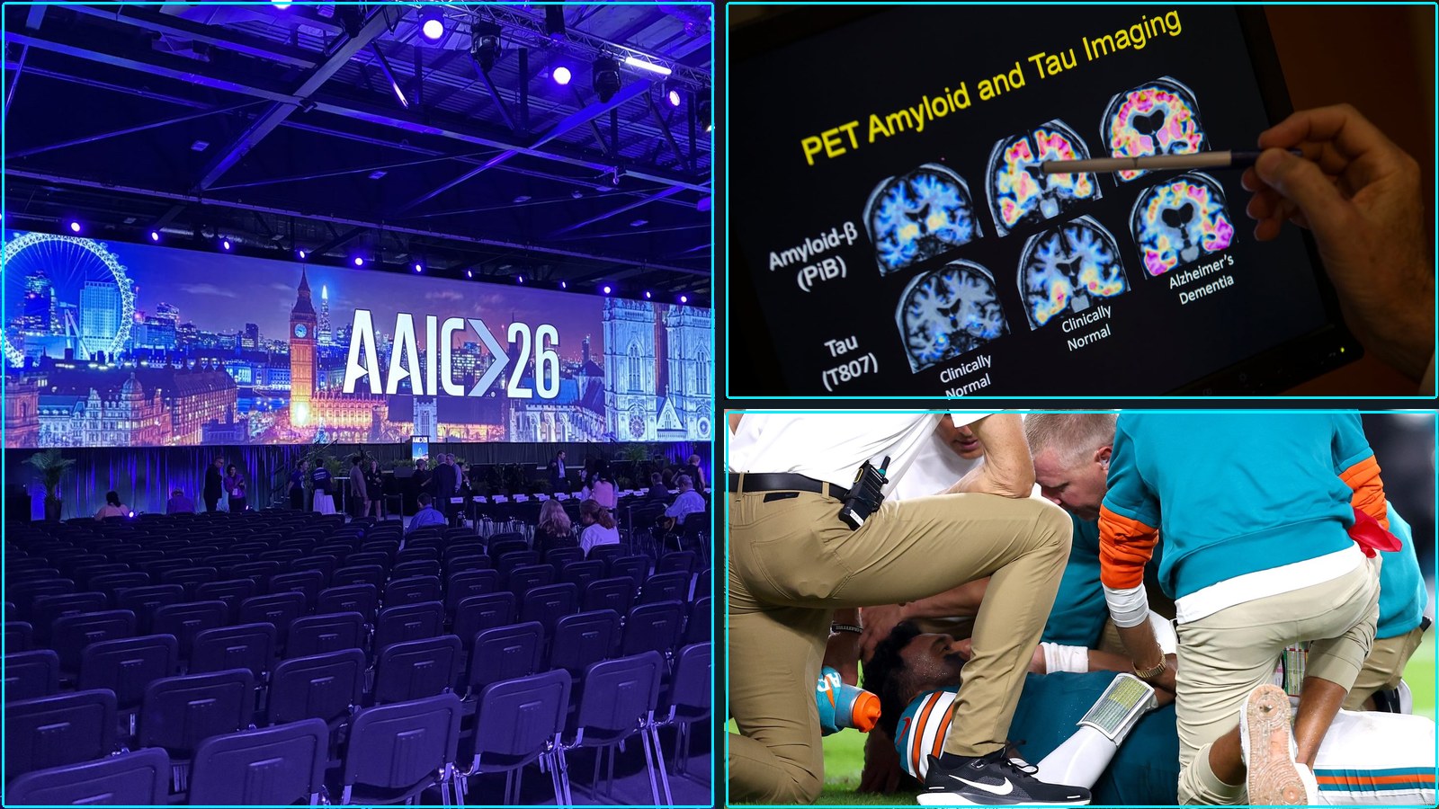 Dementia July 20, 2026: What Biogen’s anti-tau Alzheimer’s drug, AAIC 2026 Bold approaches, Cell-type signatures of, and more